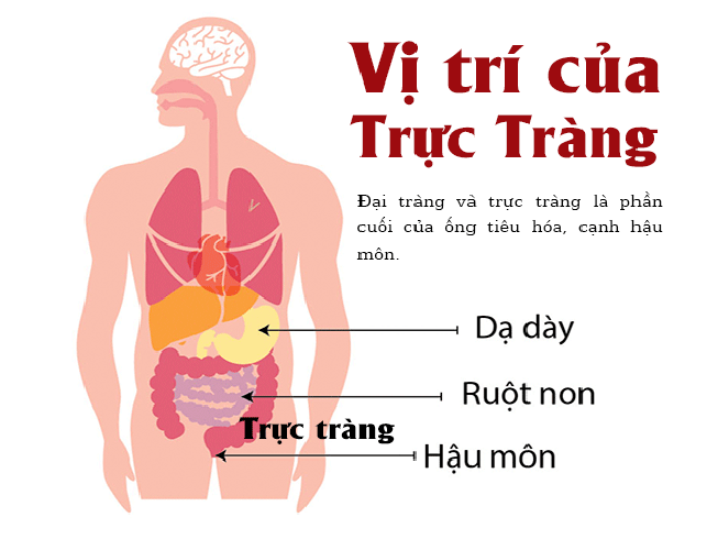 ung-thu-dai-trang