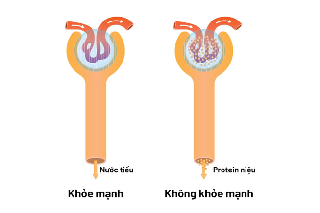 protein-nieu