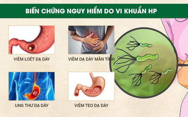 vi-khuan-hp-co-nguy-hiem-khong