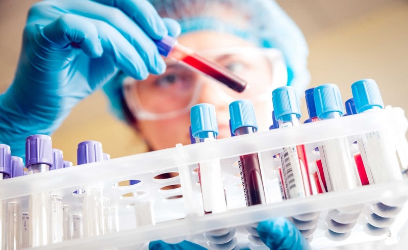 Xét nghiệm máu là gì? Xét nghiệm máu bao gồm những gì? Xét nghiệm máu giúp phát hiện ra bệnh gì?