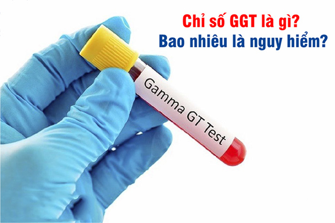 Xét nghiệm GGT là gì? Xét nghiệm GGT nhằm mục đích gì? Chỉ số GGT bình thường là bao nhiêu? Chỉ số GGT cao mắc bệnh gì?