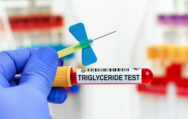 Triglyceride là gì? Xét nghiệm Triglyceride nhằm mục đích gì? Chỉ số Glyceride bao nhiêu là cao? Glyceride cao có nguy hiểm không?
