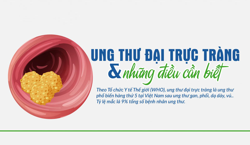 Bệnh ung thư đại trực tràng là gì? Ung thư đại trực tràng có nguy hiểm không và  có chữa khỏi được không?