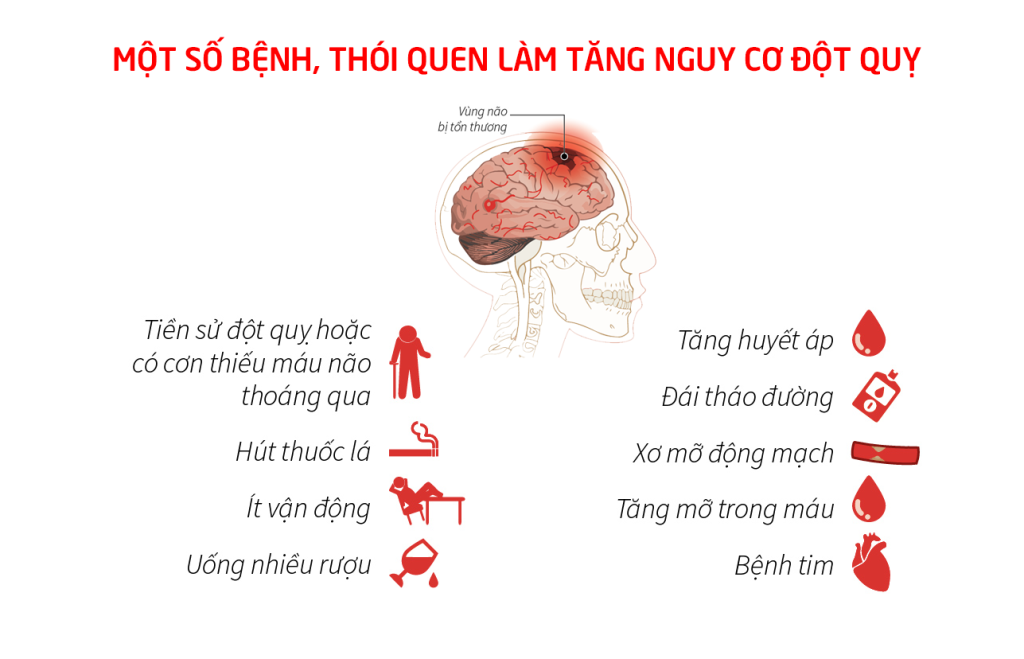 Những thói quen xấu làm tăng nguy cơ bị đột qụy